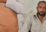 بہتر روزگار کا وعدہ، بے ہوشی اور پھر گردہ غائب؟ شہری نے سنسنی خیز انکشاف کر دیا 1 بہتر روزگار کا وعدہ، بے ہوشی اور پھر گردہ غائب؟ شہری نے سنسنی خیز انکشاف کر دیا