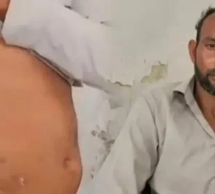 بہتر روزگار کا وعدہ، بے ہوشی اور پھر گردہ غائب؟ شہری نے سنسنی خیز انکشاف کر دیا