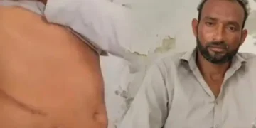 بہتر روزگار کا وعدہ، بے ہوشی اور پھر گردہ غائب؟ شہری نے سنسنی خیز انکشاف کر دیا 7 بہتر روزگار کا وعدہ، بے ہوشی اور پھر گردہ غائب؟ شہری نے سنسنی خیز انکشاف کر دیا