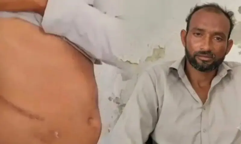 بہتر روزگار کا وعدہ، بے ہوشی اور پھر گردہ غائب؟ شہری نے سنسنی خیز انکشاف کر دیا 1 بہتر روزگار کا وعدہ، بے ہوشی اور پھر گردہ غائب؟ شہری نے سنسنی خیز انکشاف کر دیا